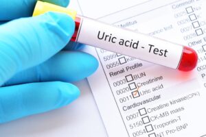 URIC ACID